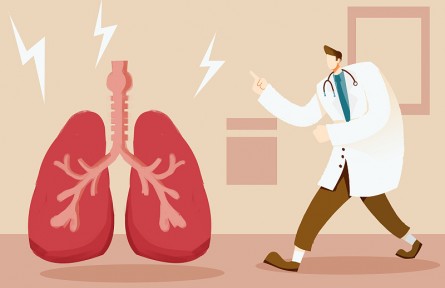 科技名词 | 肺结节 pulmonary nodule